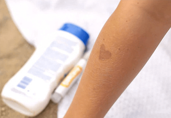 An arm has a Suncayr sticker applied to it